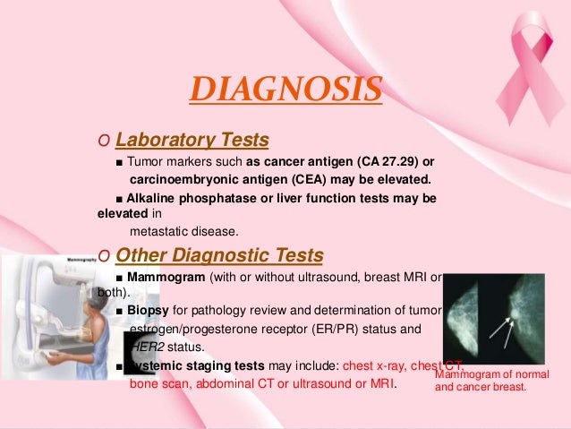 diagnosted with breast cancer Boys pictures cocks